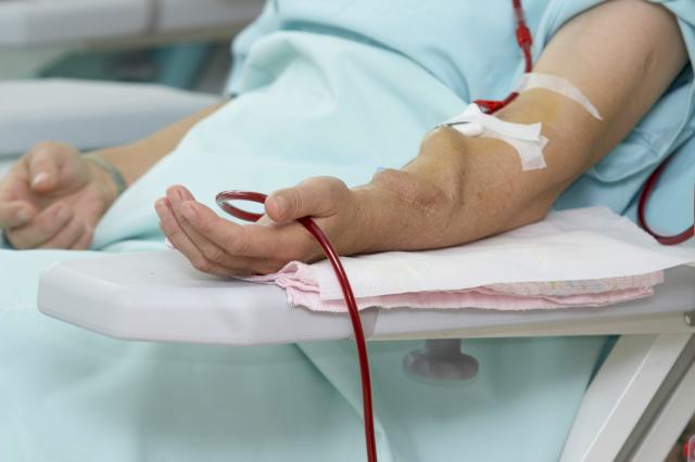 Odmašćuju krv uz pomoć aparata za dijalizu